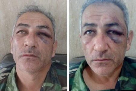 زخمی شدن یک جنگلبان توسط قاچاقچیان چوب در لوندویل آستارا